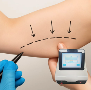 Máquina de Láser Diodo Endolaser de 1470nm y 980nm para Lifting Facial, Liposucción, Cirugía Plástica y Tratamiento de Eliminación de Bolsas de Ojos - Product Image 1