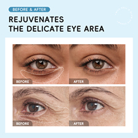 Crème pour les yeux LAIKOU Vegan Rice Ferment Filtrate Niacinamide 15g 360 Roller Hydratante Anti-rides Anti-poches Cernes