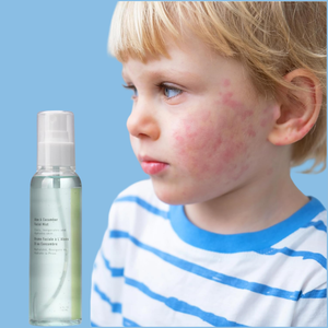 Tónico de piel Natural orgánico 100%, ácido hialurónico, hidratación, blanqueamiento, piel sensible, Control de aceite, niebla de agua de rosa, agua de Aloe <span class=keywords><strong>Bio</strong></span> - Product Image 6