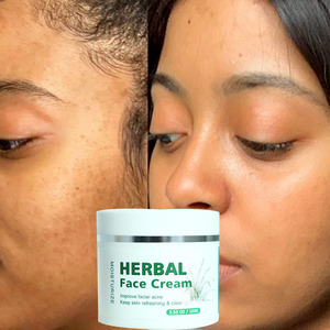 Private Label Herbal Rosto Creme Melhorar Rosto Acne Clareamento Branco Creme Poro Minimizando <span class=keywords><strong>Skincare</strong></span> Produtos De Beleza Agentes - Product Image 2