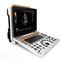 Appareil de diagnostic à ultrasons couleur Scanner à ultrasons exclusif Portable 3D/4D/5D Équipement à ultrasons médical