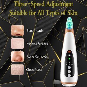 Electric Black Head Acne Removal Pore Grease <strong>Control</strong> Pore Refining Vacuum Blackhead Remover with Hot Massage - Product Image 3