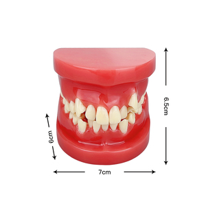 Modelo de Maloclusión Dental para Prácticas de Estudiantes de Odontología, Enseñanza, Entrenamiento, Comunicación, Equipo Médico Bucal - Product Image 2