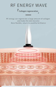 เครื่องกำจัดริ้วรอย6อิน1เครื่องคืนความอ่อนเยาว์ให้ผิวซึมลึกสำหรับร้านเสริมสวยสินค้ามาใหม่ - Product Image 2