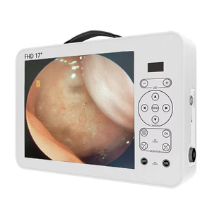 Sistema di Telecamere Mediche Portatili 1080P con Registrazione Video <span class=keywords><strong>per</strong></span> Endoscopia ORL, Ispezione Chirurgica e Artroscopia - Product Image 4
