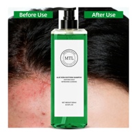 Shampoo apaisant anti-allergie à l'aloe vera biologique OEM, enrichi en ingrédients à base de plantes, apaise le cuir chevelu sec et irrité, renforce la barrière capillaire