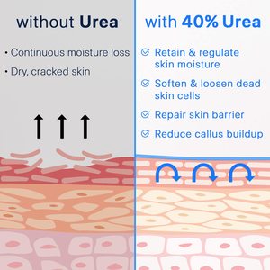 Marque privée Crème à l'urée 40% Acide salicylique 2% Crème pour les pieds à l'huile d'arbre à thé pour les talons craquelés secs Pieds Genoux Coudes Mains - Product Image 6