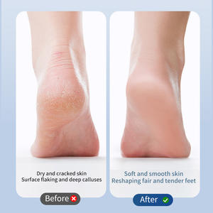 Meilleur outil de pédicure pour spa des pieds, éliminateur de callosités électronique sans fil, lime à pieds, élimine les peaux sèches, mortes, gercées, dures et les callosités - Product Image 3