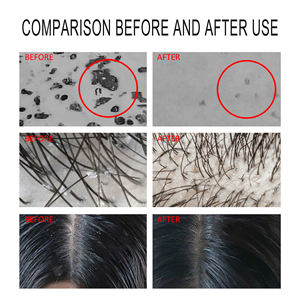 Shampooing végétalien de haute qualité formule de crème moelleuse légère au disulfure de sélénium pour le contrôle de l'huile rafraîchissant lisse nourrissant gratuit - Product Image 6