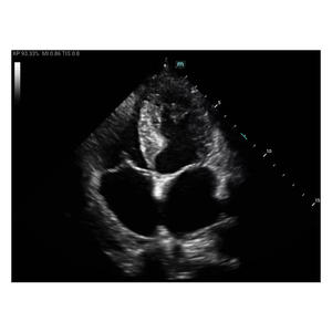 Mingray MX3 peralatan <span class=keywords><strong>Ultrasound</strong></span>, alat diagnostik portabel untuk penggunaan dokter hewan - Product Image 4