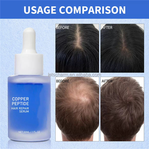 Suero <span class=keywords><strong>para</strong></span> <span class=keywords><strong>el</strong></span> Crecimiento del <span class=keywords><strong>Cabello</strong></span> con Péptidos de Cobre Azul <span class=keywords><strong>para</strong></span> Reparar <span class=keywords><strong>el</strong></span> <span class=keywords><strong>Cabello</strong></span> Dañado y Mejorar <span class=keywords><strong>el</strong></span> Cuero Cabelludo - Fabricante de Productos <span class=keywords><strong>para</strong></span> <span class=keywords><strong>el</strong></span> Cuidado de la Piel OEM - Product Image 4