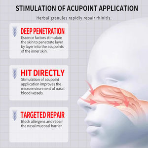 Индивидуальный пластырь для стимуляции давления в носу, китайский пластырь для снятия заложенности носа и давления в носовых Пазухах - Product Image 3
