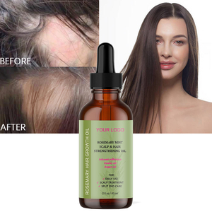 Commercio all'ingrosso rapido diradamento capelli raddrizzamento Anti perdita di capelli siero rosa maria ispessimento capelli crescere olio per gli uomini - Product Image 5