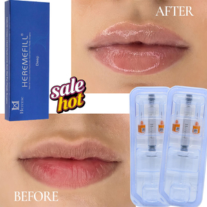 Relleno Labial <span class=keywords><strong>de</strong></span> Ácido Hialurónico Biofermentado <span class=keywords><strong>de</strong></span> Alta Pureza, Gel HA Reticulado <span class=keywords><strong>para</strong></span> <span class=keywords><strong>Aumento</strong></span> Labial <span class=keywords><strong>de</strong></span> Larga Duración, Aprobado por la CE - Product Image 3