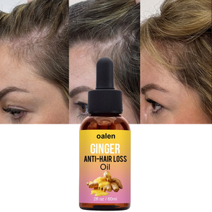 Aceite de Tratamiento Capilar de Jengibre Luxfume, Natural, Anticaída, Previene la Calvicie, Crecimiento Rápido, Nutritivo para Cabello Seco y Dañado - Product Image 1