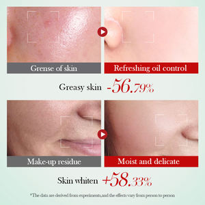 علامة تجارية خاصة سادير مستحضرات التجميل الكورية نياسيناميد منظف تبييض الوجه تنظيف المسام ترطيب لطيف رغوة غسول الوجه - Product Image 4