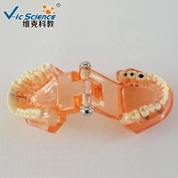 Restauration avec implant modèle de dents dentaires modèle d'enseignement des sciences médicales modèle de dents humaines