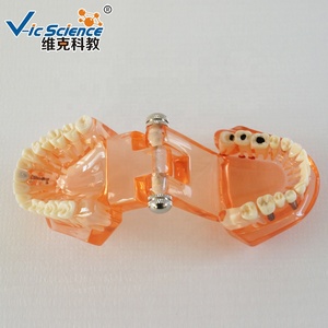 نموذج تعليم العلوم الطبية البشري من خلال زراعة الأسنان - Product Image 4