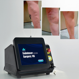 Máquina de ablación láser <span class=keywords><strong>vascular</strong></span> mínimamente invasiva e indolora de 980nm/1470nm, tratamiento láser EVLT para arañas vasculares y varices - Product Image 4