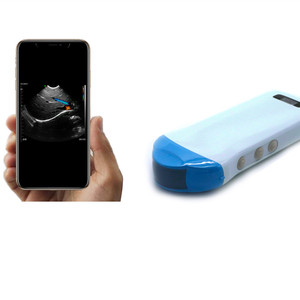 Venta caliente médica 192 elementos 5g ultrasonido inalámbrico Micro sonda convexa - Product Image 3