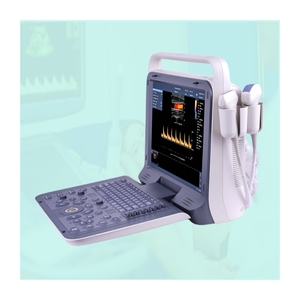 High-End portátil Color <span class=keywords><strong>Doppler</strong></span> Machine para Dog Imaging com 3.5 MHz Convex <span class=keywords><strong>Probe</strong></span> - Product Image 1