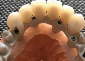 Résine PEEK de qualité supérieure, vierge, blanche, naturelle, de qualité implant médical, antistatique, résistante aux produits chimiques, pour fibres dentaires - Product Image 6