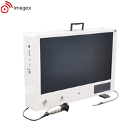 Système de caméra d'endoscopie médicale Full HD avec fonction d'enregistrement pour laparoscopie et arthroscopie