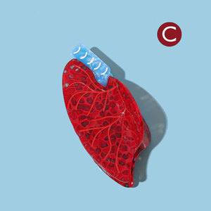 Cá nhân y tá y tế <span class=keywords><strong>Clip</strong></span> mới lạ Acetate chất liệu có tính năng bụng dạ dày phổi tử cung xương và tóc Claw <span class=keywords><strong>Clip</strong></span> - Product Image 1