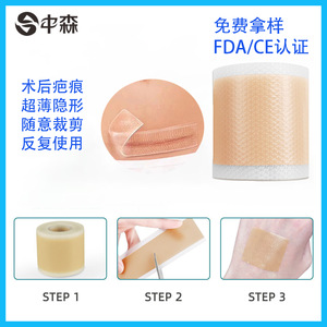 Patchs cicatrisants en silicone Nakamori, épaisseur 0,3 mm, réutilisables pour l'élimination des cicatrices de césarienne - Product Image 5