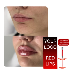 Remplisseur Lèvres Rouge Injectable Sûr 1ml avec Vitamine B12 et <span class=keywords><strong>Acide</strong></span> <span class=keywords><strong>Hyaluronique</strong></span> – Redéfinit les Lignes des Lèvres – <span class=keywords><strong>Prix</strong></span> Usine Compétitif en Gros - Product Image 1