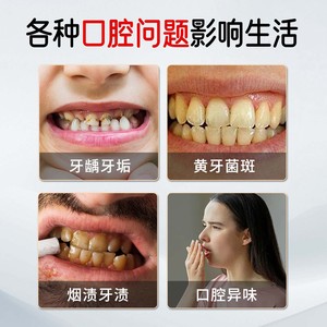Pasta dental anticaries personalizada, previene la caries, protege el esmalte dental, nutre las encías, fortalece los dientes y es - Product Image 4