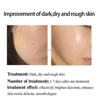 ÉTIQUETTE PRIVÉE dermapen aiguilles microneedling sérum ampoule professionnelle sérum à base d'eau