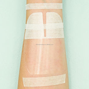 Film PU transparan IV bingkai takik U Border balutan U 8.5x10.5cm bersertifikat CE Kelas I EO disinfeksi IV kateter kanula - Product Image 3