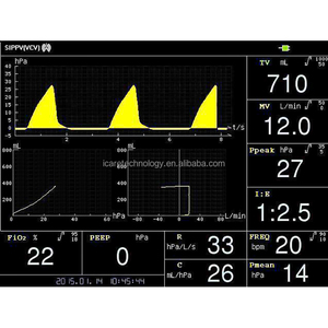 Ventilador I Care con Sistema de Alarma Avanzado para Mayor Seguridad – Monitoreo en Tiempo Real, Alarmas y Control Preciso para Cuidados Críticos - Product Image 6