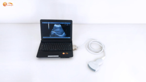 เครื่องอัลตราซาวนด์สัตว์แบบพกพา ขาวดำ สำหรับสัตว์ต่างๆ เช่น สุนัข แมว แกะ หมู วัว ม้า - Product Image 3