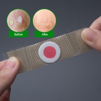 Patch anti-callosités pour les pieds, vente chaude, à base de plantes, nourrissant, pour soulager la douleur des callosités plantaires, pansement médical