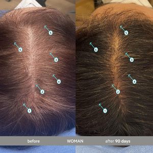 Siero per la Densità dei Capelli ETRUN ALISA 60mL, Trattamento Leggero Senza Risciacquo per Capelli dall'Aspetto Più Folti e Spessi, Anti-Grigio Preserva il Pigmento - Product Image 4