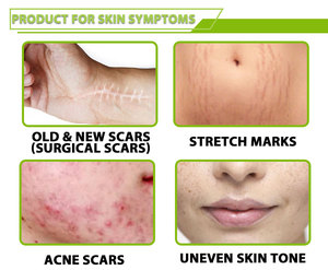 Crème anti-acné thaïlandaise pour hommes et femmes, éliminateur de cicatrices et de boutons avec niacinamide et acide salicylique, éliminateur d'acné du visage - Product Image 3