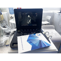 K-C102 Portable 15 pouces écran vétérinaire entièrement numérique ordinateur portable 3D 4D couleur Doppler Diagnostic Machine à ultrasons