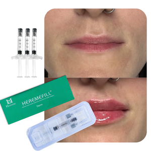 Meilleur <span class=keywords><strong>Prix</strong></span> 1ml 2ml <span class=keywords><strong>Acide</strong></span> <span class=keywords><strong>Hyaluronique</strong></span> de Qualité Cosmétique Dermique pour <span class=keywords><strong>Injection</strong></span>, Remplissage Facial et Lèvres, Technique des Lèvres Russes - Product Image 2