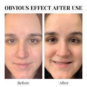 Tonique facial au riz noir fermenté OEM, eau d'essence de riz hydratante et antioxydante, soin apaisant non irritant à absorption rapide - Product Image 5