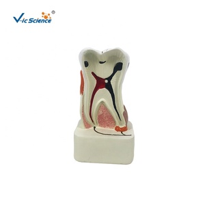 Modelo <span class=keywords><strong>de</strong></span> Patología Dental para Educación Dental y Laboratorio Dental, Modelo <span class=keywords><strong>de</strong></span> Estudio Dental - Product Image 1