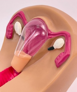 Simulador de Ciencias Médicas, Serie de Enseñanza Médica, Modelo de Guía de Anticoncepción y Parto - Product Image 2