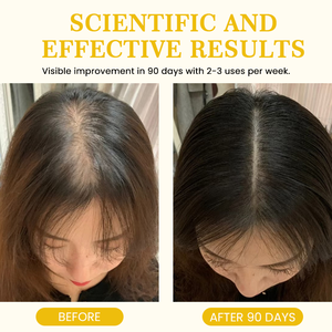 زيت أساسي لنمو الشعر، للعناية بفروة الرأس، مرطب، مقوي، يتحكم في التساقط، يغذي بصيلات الشعر للحصول على شعر كثيف - Product Image 5