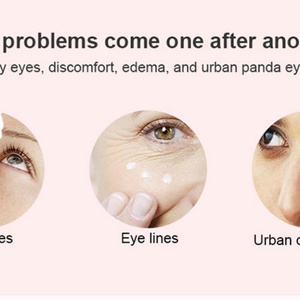 Masajeador de Ojos Frío y Caliente, Dispositivo para Aliviar la Fatiga Ocular - Product Image 6