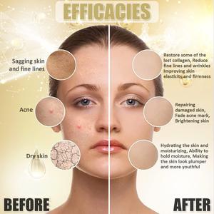 Lance Argireline đường viền Bột mặt nạ nhãn hiệu riêng dòng chuyên sâu nếp nhăn lỗ chân lông lớn làm săn chắc đường viền Mặt nạ bột - Product Image 2