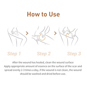 LANBENA Sivilce Yara Izi Kaldırma <span class=keywords><strong>Serum</strong></span> Akne Tedavisi Sökücü Streç Işaretleri <span class=keywords><strong>Anti</strong></span> Akne Gözenekleri Küçültmek Siyah Nokta beyazlatıcı krem Cilt Bakımı - Product Image 2