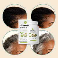 Complément Herbal à Marque Blanche pour la Croissance Capillaire : Résultats Rapides, Amélioration de la Croissance des Cheveux Sauvages chez la Femme, Favorise des Cheveux Plus Épais et Plus Denses