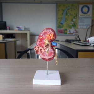 Medisch Wetenschappelijk Product Pathologisch Anatomiemodel Van Niercyste Nierziekte Model Menselijk Anatomiemodel - Product Image 4