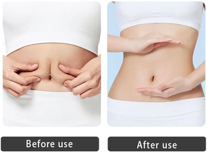 2026 Professional 6 in 1 Triple <strong>Lipocavitation</strong> Ultrasonic 40k Cavitation Kim 8 Slimming <strong>Machine</strong> Lipolaser 4d - Product Image 4